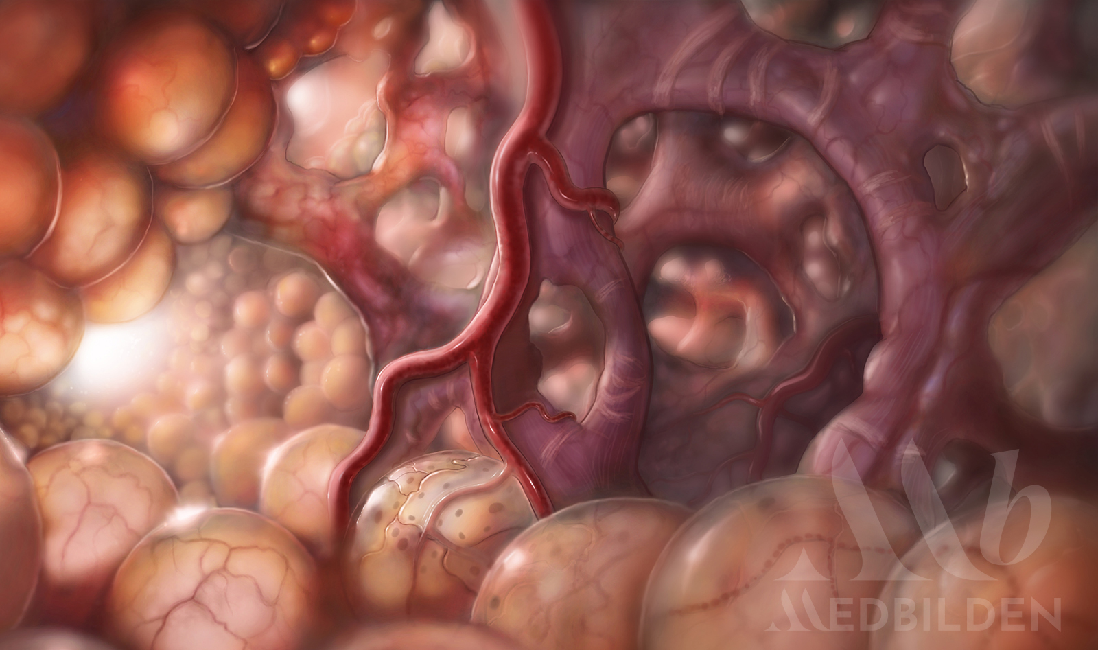 Medical Illustration of alveoli